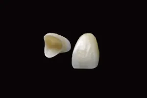 被せ物_ジルコニア